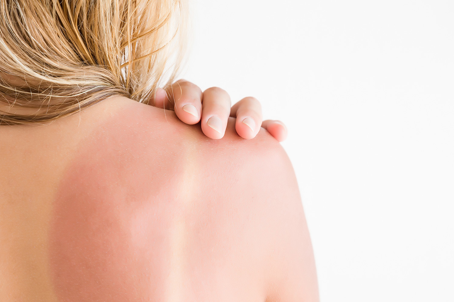 What damage does the sun do to our skin?
